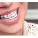 previous thumbnail